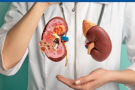 Sindrom nefrotic: cauze, diagnostic si tratament