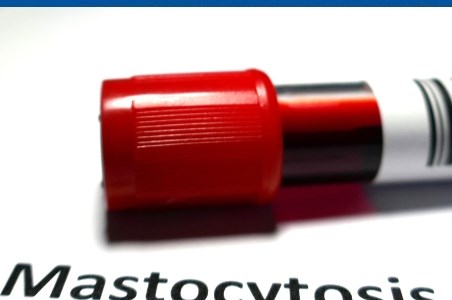 Mastocitoza: ce este si cum se manifesta?