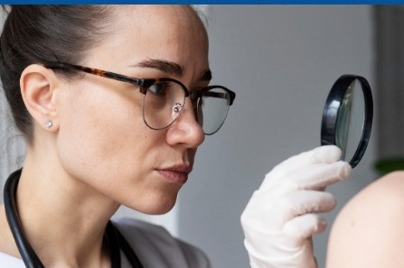 Eritem: cauze, tipuri, diagnostic si tratament