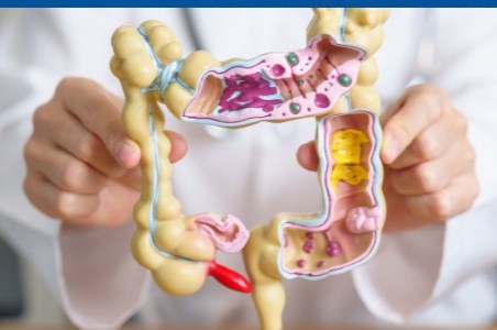 Cand este recomandata excizia polipilor pe colon?