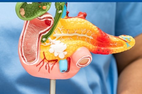 Tot ceea ce trebuie sa stii despre pancreatita