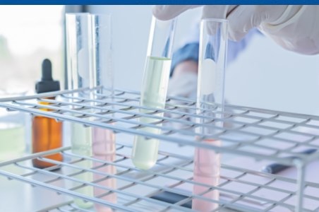 Mucus in urina: cauze si semne de ingrijorare