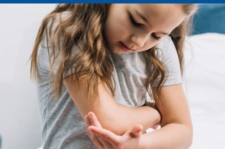 Muscatura de purice este periculoasa pentru om?