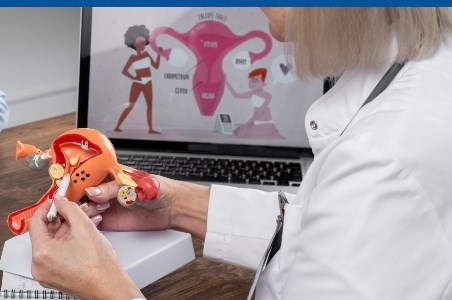 Sterilet: tipuri, eficienta, intretinere si riscuri