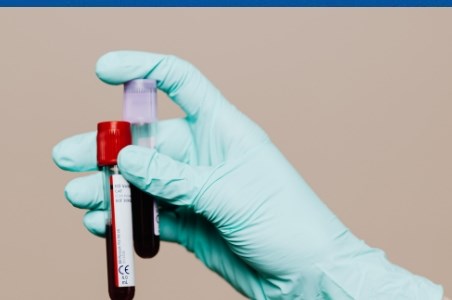 Siclemie: simptome, diagnostic, tratament si complicatii