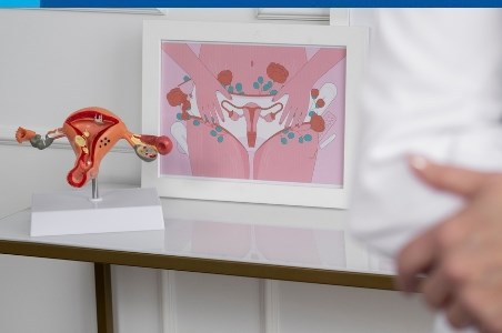 Histeroscopia operatorie: cand este necesara si cum se realizeaza