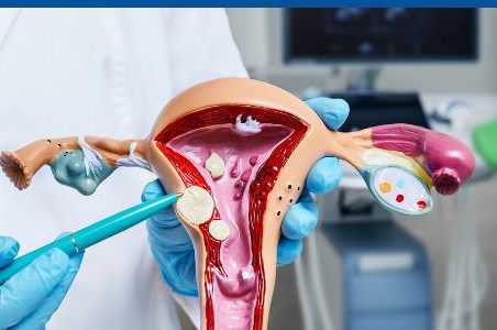 Fibrom uterin: cand trebuie operat?