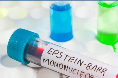 Infectia cu virusul Epstein-Barr la copii si adulti
