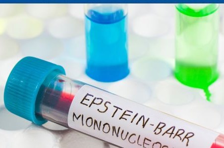 Infectia cu virusul Epstein-Barr la copii si adulti
