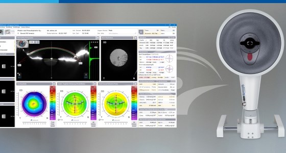 Tehnologie de ultima generatie pentru evaluarea si monitorizarea sanatatii ochilor