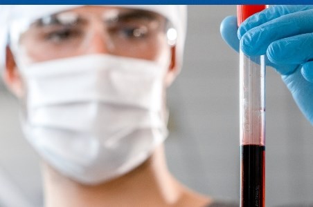 Policitemia vera: cauze, simptome si tratament