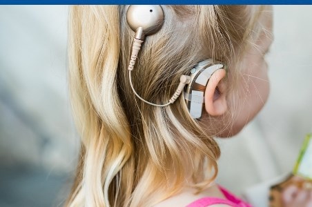 Implant cohlear: cum functioneaza si prin ce difera de aparatul auditiv?